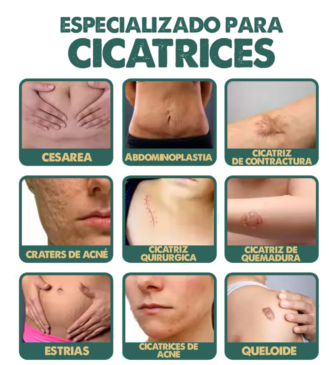 South Moon® - Spray Regenerador para Cicatrices.
