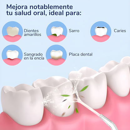 Dentaflow® - Irrigador Dental Limpieza Profunda