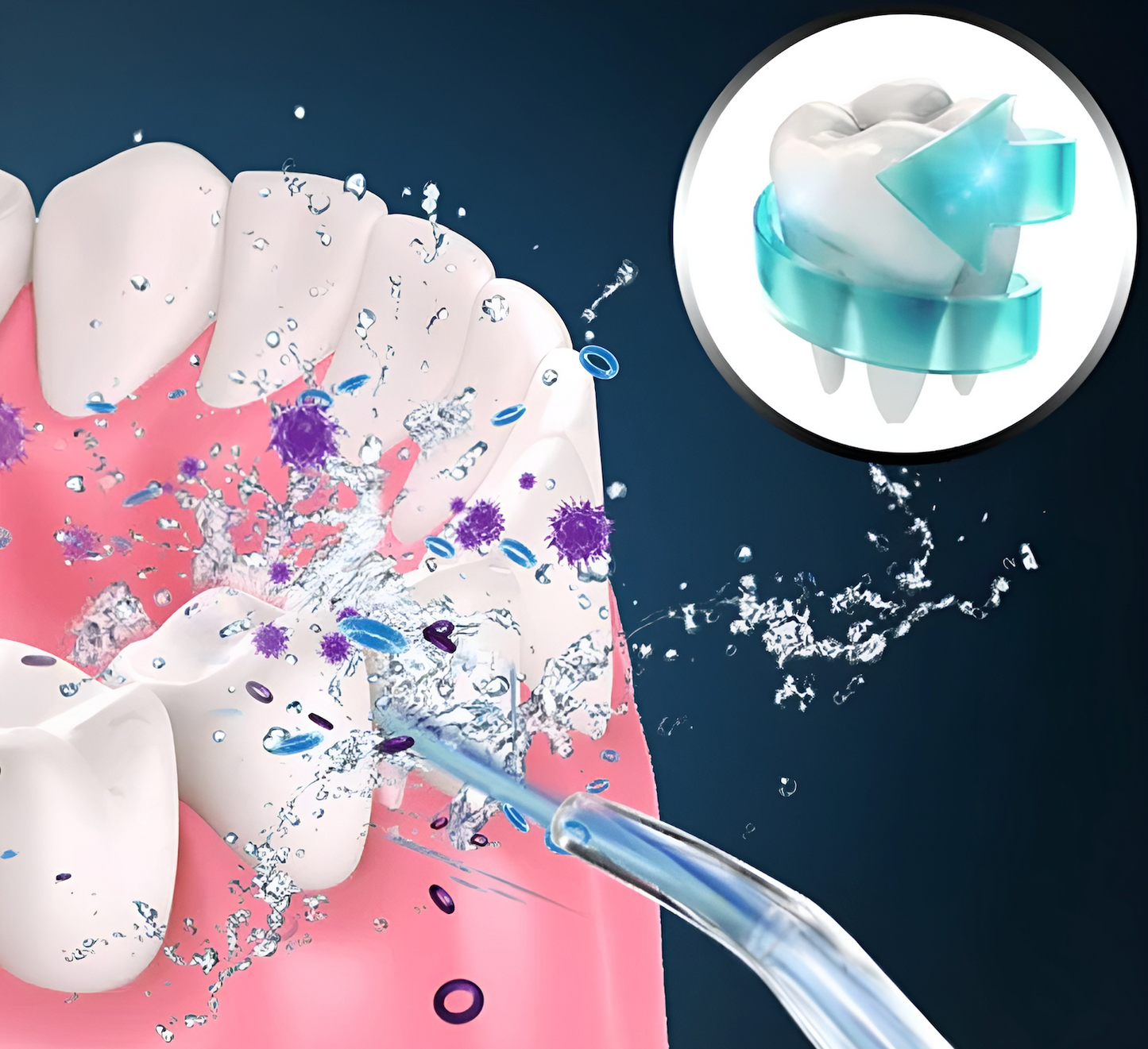 Dentaflow® - Irrigador Dental Limpieza Profunda