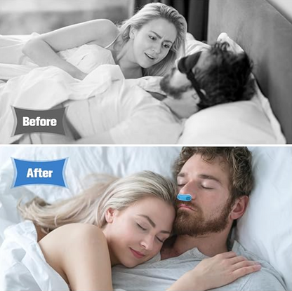 ANTIRONQUIDO 2x1 - Dilatador Nasal y Purificador de Aire