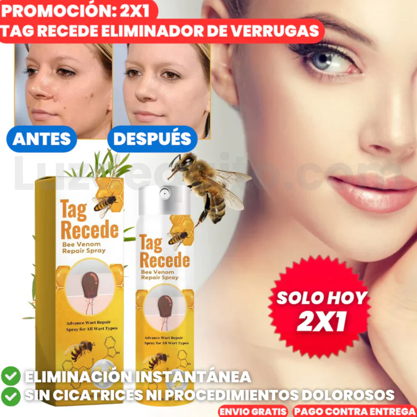 Oferta Especial 2x1: Eliminador de Verrugas
