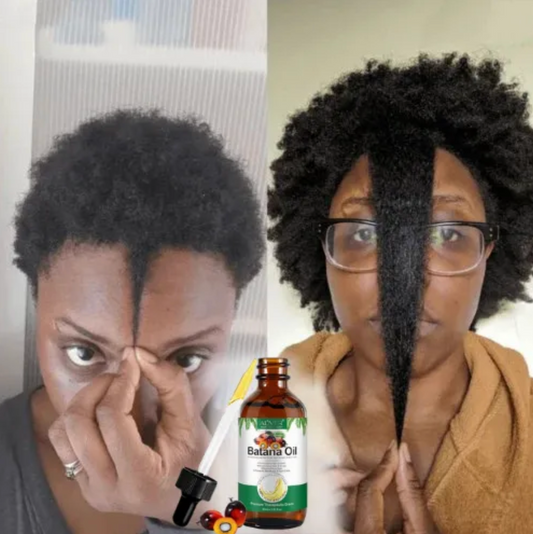 Aceite de Batana para el crecimiento del cabello 100% natural